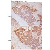 Solarbio K111760P Anti-PJA1 Polyclonal Antibody