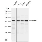 Solarbio K111799P Anti-RPAP3 Polyclonal Antibody