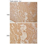 Solarbio K110944P Anti-FBXL5 Polyclonal Antibody