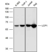 Solarbio K110543P Anti-LCP1 Polyclonal Antibody