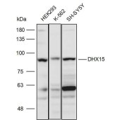 Solarbio K111410P Anti-DHX15 Polyclonal Antibody