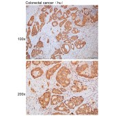 Solarbio K111781P Anti-PIGS Polyclonal Antibody