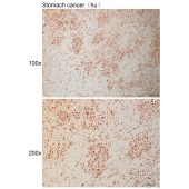 Solarbio K110992P Anti-NUP35 Polyclonal Antibody