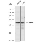 Solarbio K111009P Anti-MIPOL1 Polyclonal Antibody
