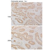 Solarbio K111261P Anti-GPR42 Polyclonal Antibody