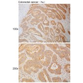 Solarbio K111080P Anti-PFKP Polyclonal Antibody