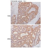 Solarbio K111494P Anti-ADAM17(Cleaved-Arg215) Polyclonal Antibody