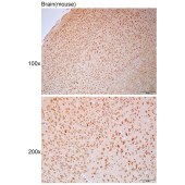 Solarbio K112130P Anti-RNF166 Polyclonal Antibody