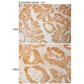 Solarbio K111124P Anti-ADGRE5(Cleaved-Leu530) Polyclonal Antibody