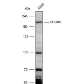 Solarbio K111691P Anti-DOCK5 Polyclonal Antibody