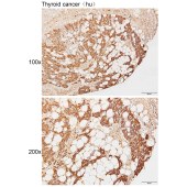 Solarbio K111269P Anti-GALK1 Polyclonal Antibody