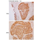 Solarbio K111704P Anti-SMG6 Polyclonal Antibody