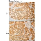 Solarbio K110944P Anti-FBXL5 Polyclonal Antibody