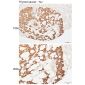 Solarbio K111442P Anti-TPI1 Polyclonal Antibody