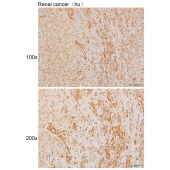 Solarbio K111420P Anti-HAO2 Polyclonal Antibody