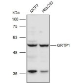 Solarbio K111255P Anti-GRTP1 Polyclonal Antibody
