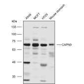 Solarbio K110830P Anti-CAPN9 Polyclonal Antibody