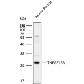Solarbio K111970P Anti-TNFSF13B Polyclonal Antibody