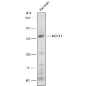 Solarbio K111638P Anti-KCNT1 Polyclonal Antibody