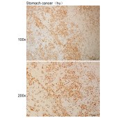 Solarbio K110956P Anti-NUPR1 Polyclonal Antibody