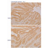 Solarbio K110555P Anti-UCP2 Polyclonal Antibody