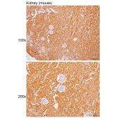 Solarbio K111705P Anti-SRP14 Polyclonal Antibody