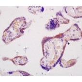 Solarbio K009947P Anti-ABCG2 Polyclonal Antibody