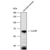 Solarbio K111774P Anti-IL23R Polyclonal Antibody
