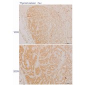 Solarbio K110594P Anti-RLN1 Polyclonal Antibody
