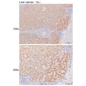 Solarbio K111079P Anti-PFKL Polyclonal Antibody