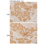 Solarbio K111929P Anti-LSM6 Polyclonal Antibody