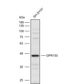 Solarbio K111626P Anti-GPR150 Polyclonal Antibody
