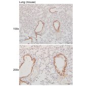 Solarbio K111617P Anti-LYPD4 Polyclonal Antibody