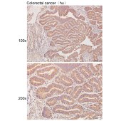 Solarbio K111014P Anti-B3GALNT1 Polyclonal Antibody