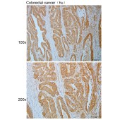 Solarbio K110840P Anti-RPS6KA6 Polyclonal Antibody