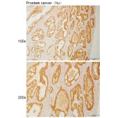 Solarbio K111035P Anti-COMMD2 Polyclonal Antibody