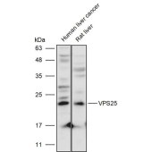 Solarbio K111416P Anti-VPS25 Polyclonal Antibody