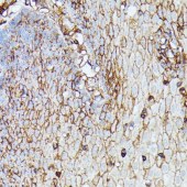 Solarbio K009916P Anti-HLA-B（HLA Class I） Polyclonal Antibody