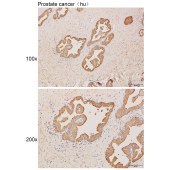Solarbio K111957P Anti-COQ10B Polyclonal Antibody