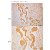 Solarbio K110592P Anti-PAK5 Polyclonal Antibody