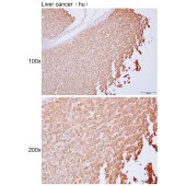 Solarbio K111678P Anti-MSR1 Polyclonal Antibody