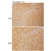 Solarbio K110718P Anti-OSTF1 Polyclonal Antibody