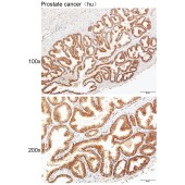 Solarbio K111457P Anti-TCF12 Polyclonal Antibody