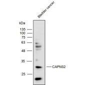 Solarbio K111770P Anti-CAPNS2 Polyclonal Antibody