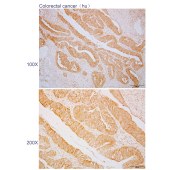 Solarbio K110568P Anti-PRKCI Polyclonal Antibody