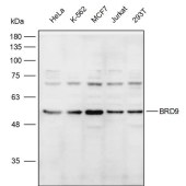 Solarbio K111952P Anti-BRD9 Polyclonal Antibody