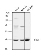 Solarbio K112118P Anti-SCLY Polyclonal Antibody