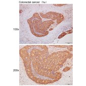 Solarbio K111700P Anti-KIAA1841 Polyclonal Antibody