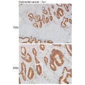 Solarbio K111943P Anti-BMPR2 Polyclonal Antibody