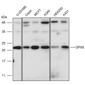 Solarbio K111449P Anti-GPX8 Polyclonal Antibody
